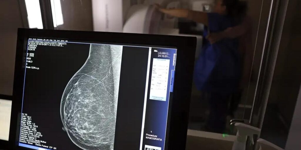 Nova lei amplia direito à folga para exames preventivos: veja quais